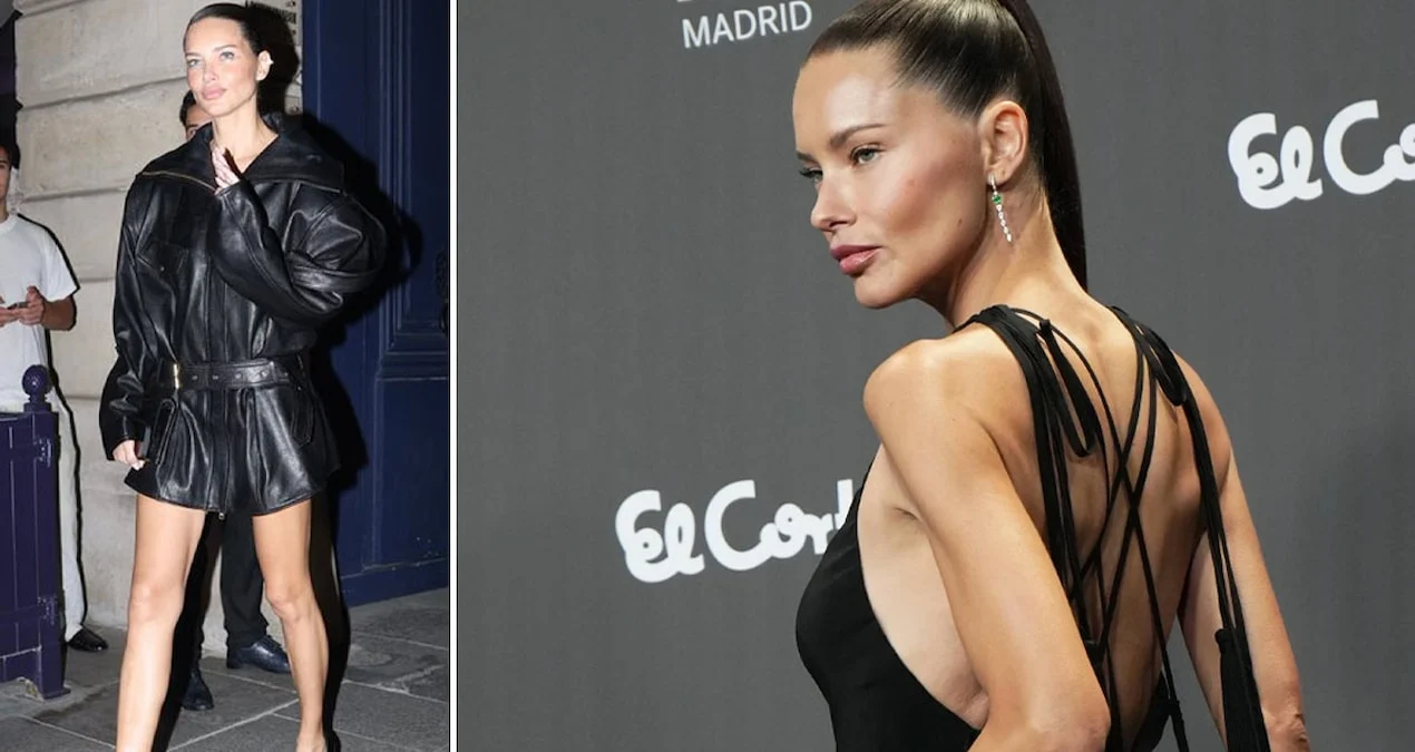 Adriana Lima’nın son hali şaşırttı: Bacaklarıyla ilgili yorum yağmuruna tutuldu