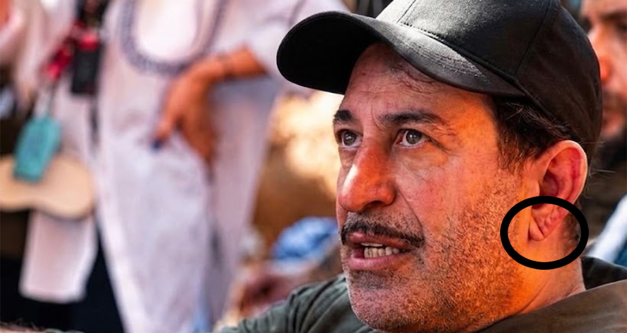 Cem Yılmaz’ın kulak memesindeki çizgi kalp sağlığı hakkında ipucu verebilir mi