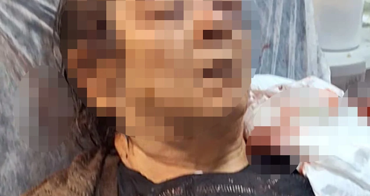 Kayseri'de tavandan moloz düşmesi sonucu 75 yaşındaki kadın yaralandı - www.gundemedair.com