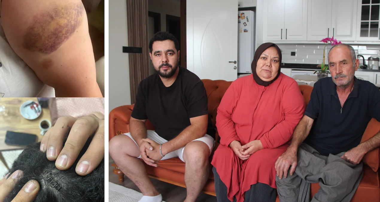 Adana'da ev basıp dehşeti yaşattılar: "Oğluma keserle, eşime zincirle saldırdılar!"