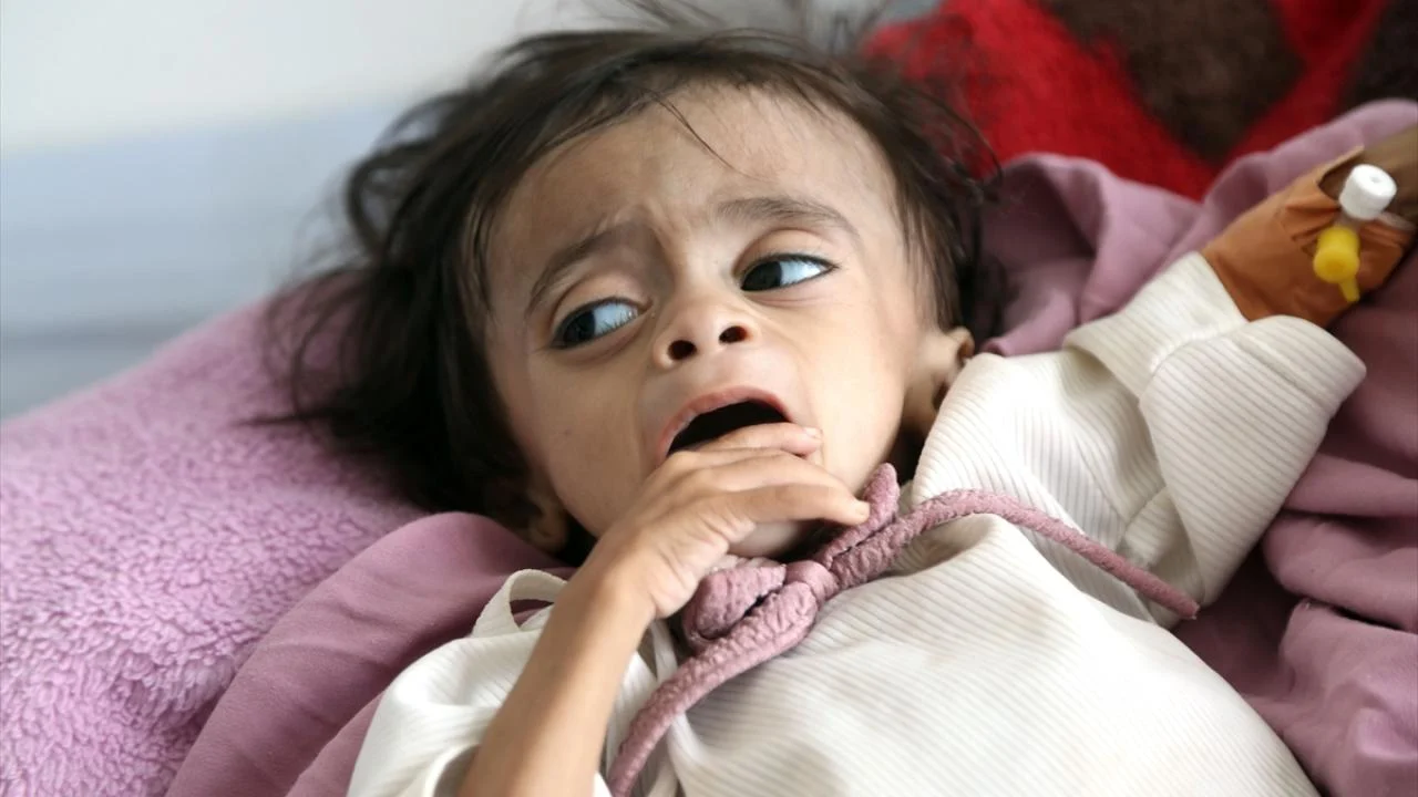 BM’den Yemen’de insani kriz uyarısı