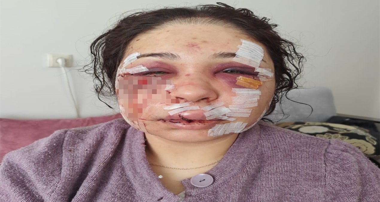 Ankara’da boşanma sürecindeki eşi darbedilen polis memuruna verilen hapis cezası haberi