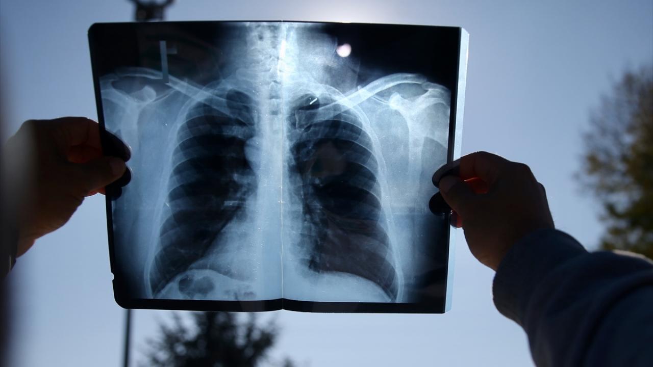 İspanya, 114 yıl aradan sonra güneş tutulmasına hazırlanıyor