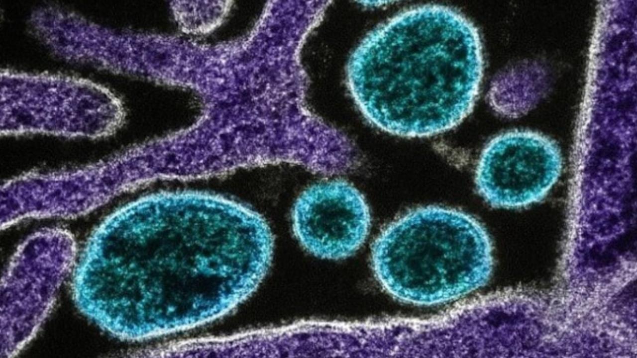 Yapay zeka ile tasarlanan 16 yeni virüs bakterileri enfekte etmek için üretildi