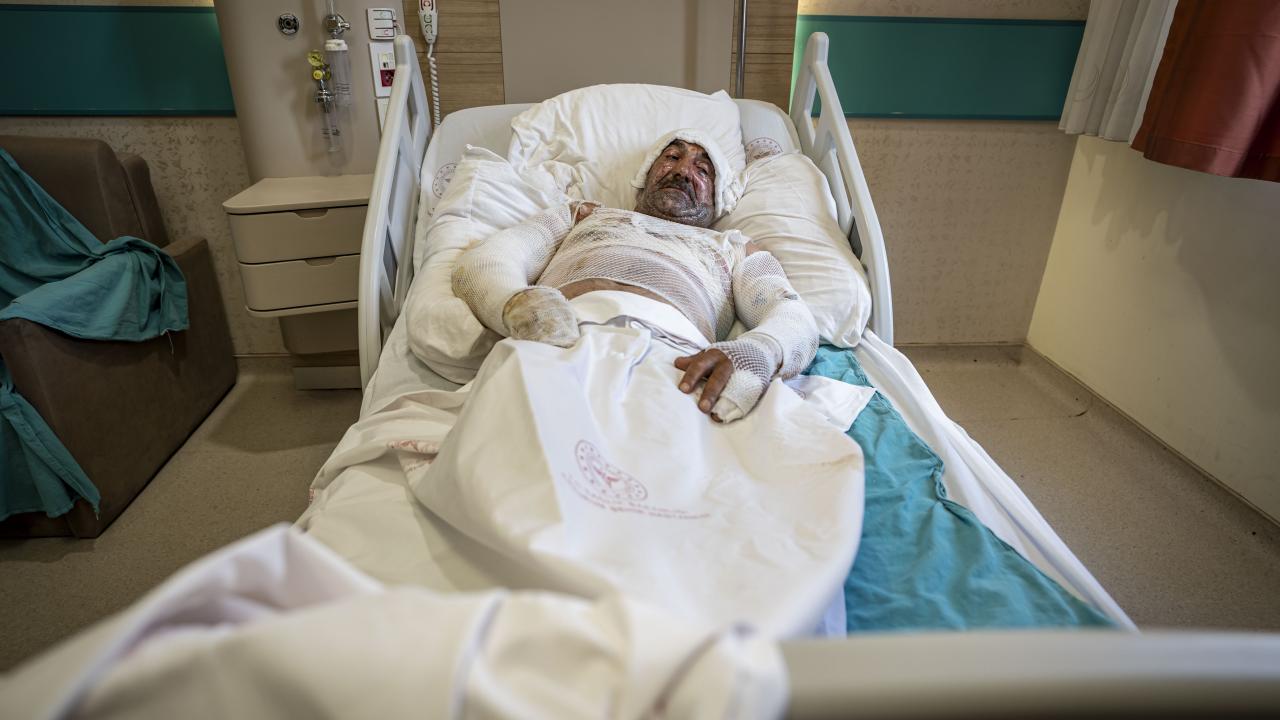 Kars’ta benzin sızması sonucu meydana gelen parlamada çift yaralandı